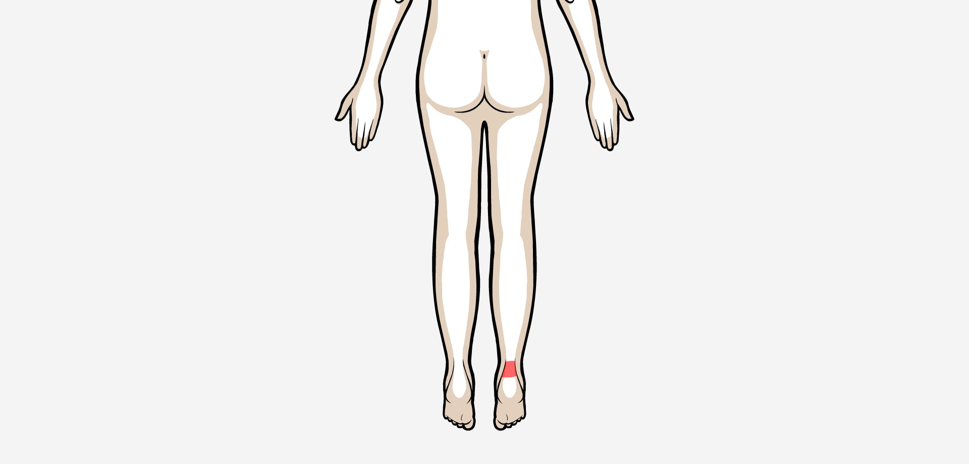 Dolor posterior Aquiles